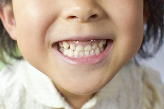 小児矯正歯科は保険適用できる？