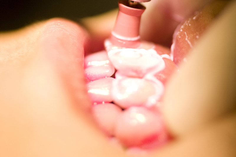 当院の予防歯科
